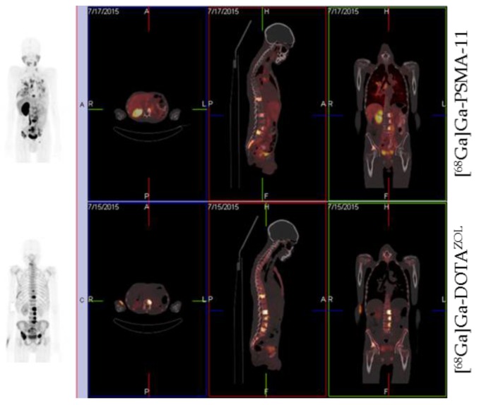 Figure 15