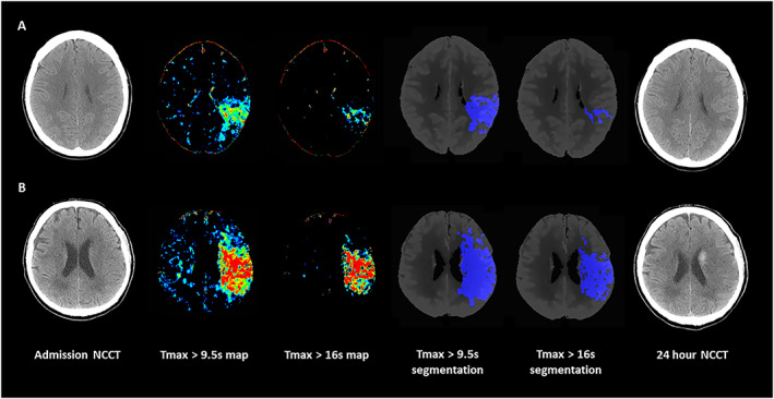 FIGURE 3