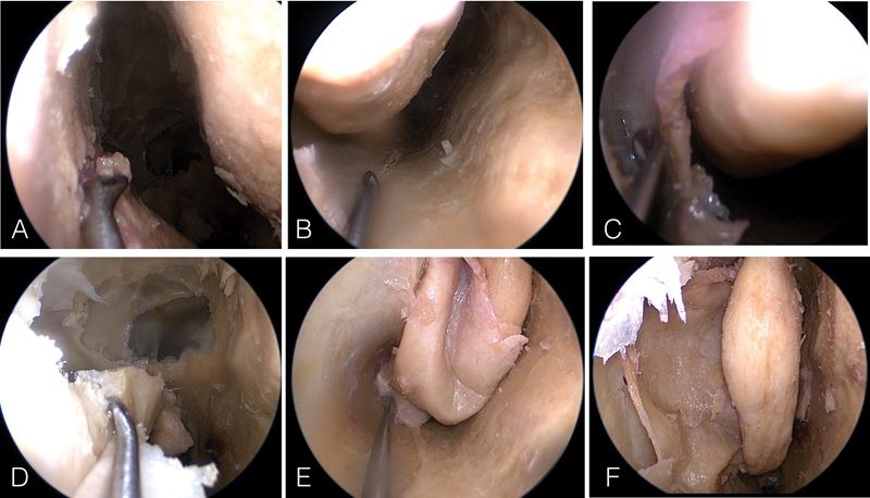 Fig. 5
