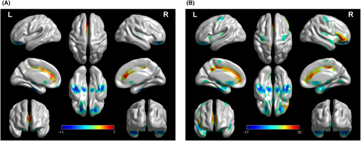 FIGURE 3