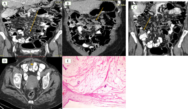 Figure 4.