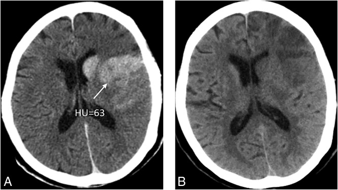 Fig 5.