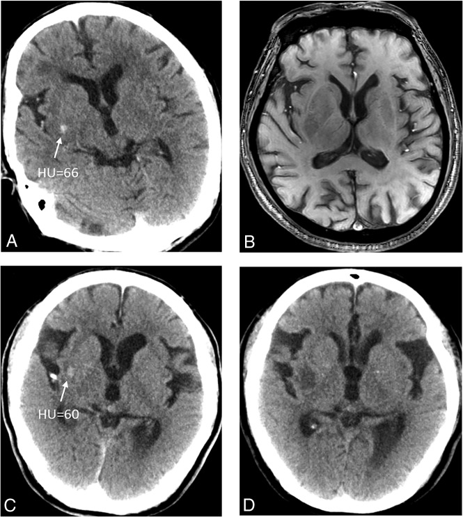 Fig 3.