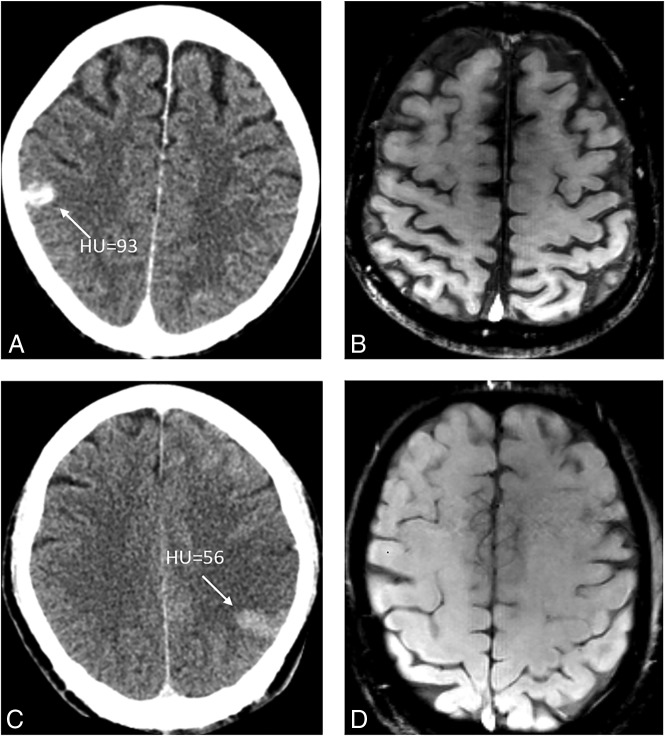 Fig 2.