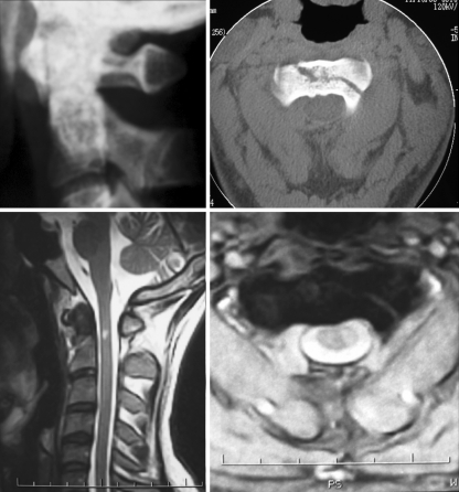 Fig. 1