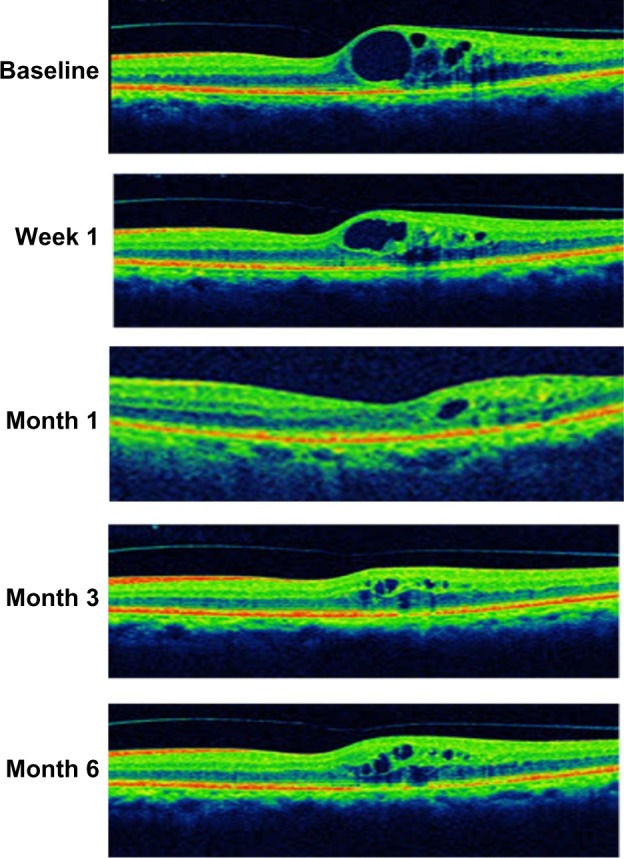 Figure 6