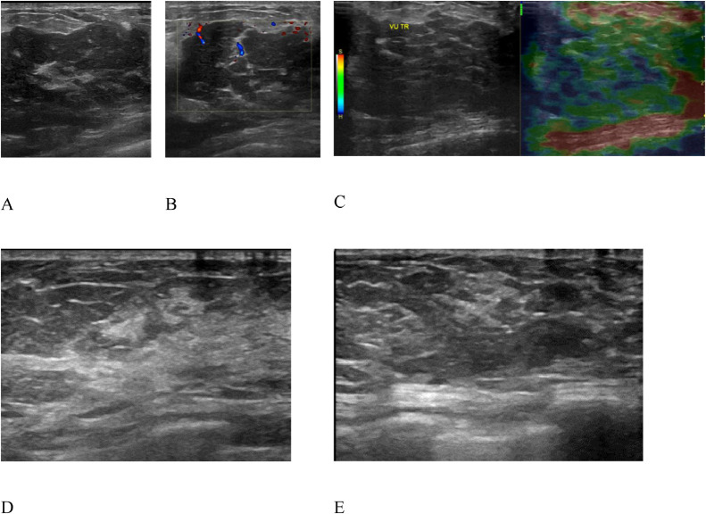 Fig 3 –