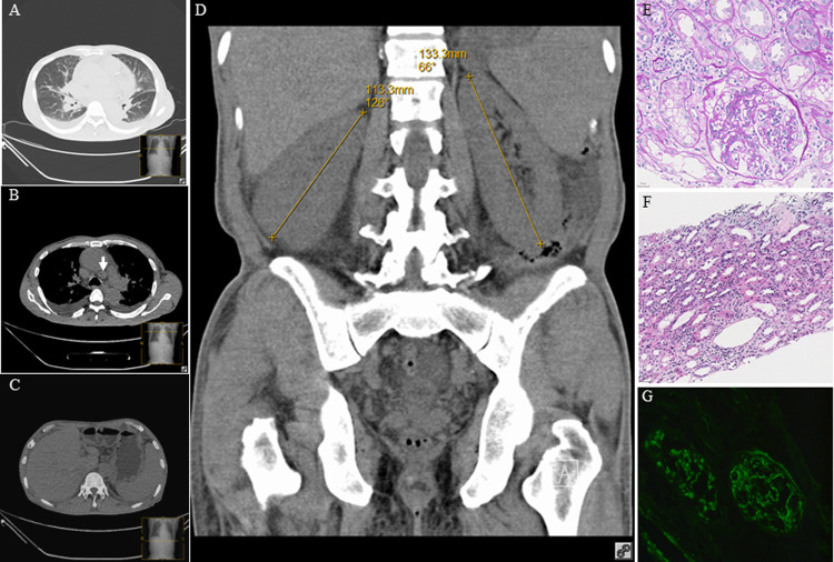 Fig 1