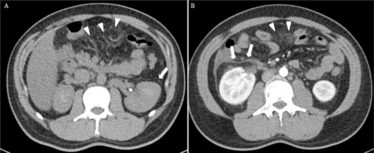 Fig 2