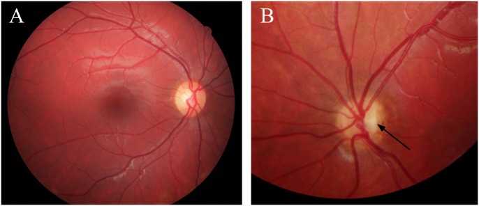 Fig 5