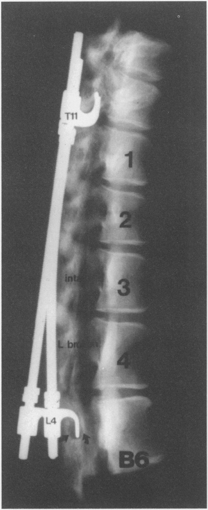 Figure 5A