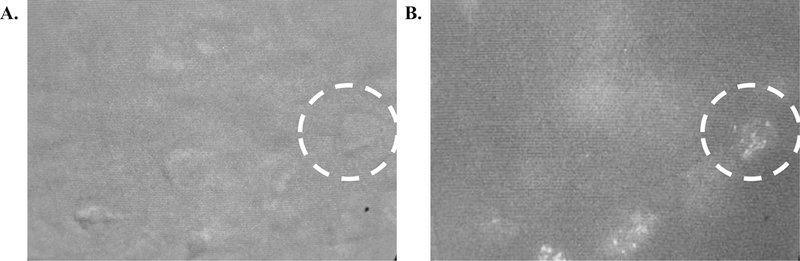 Figure 11: