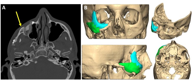 Figure 11