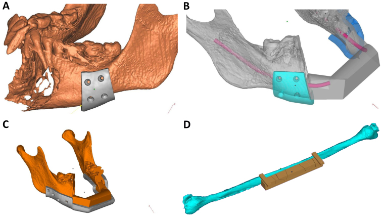 Figure 4