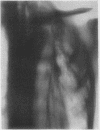 246