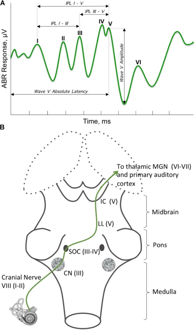 FIGURE 3