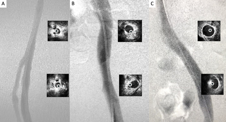 Figure 9