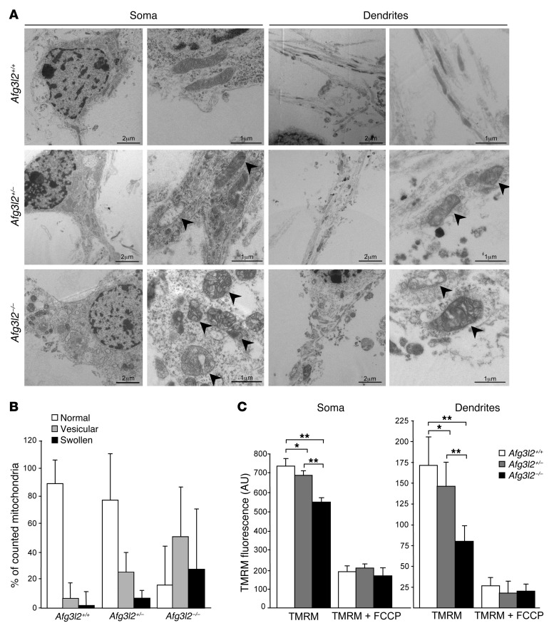 Purkinje neuron Ca2+ influx reduction rescues ataxia in SCA28 model - PMC