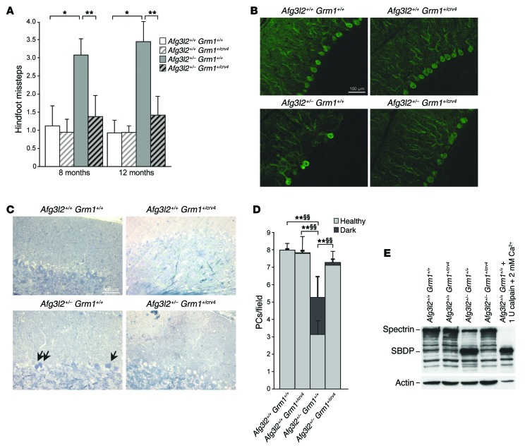 Purkinje neuron Ca2+ influx reduction rescues ataxia in SCA28 model - PMC