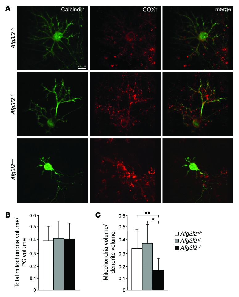 Purkinje neuron Ca2+ influx reduction rescues ataxia in SCA28 model - PMC