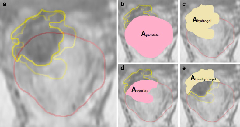 Figure 2