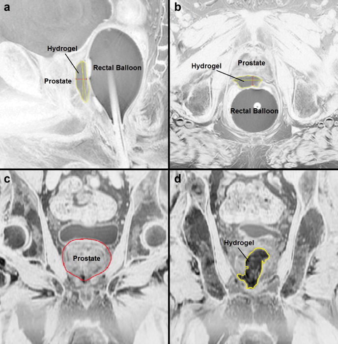 Figure 1