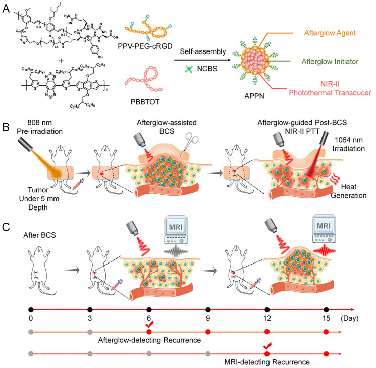 Schematic: using APPN for adjuvant therapy and early recurrence diagnosis