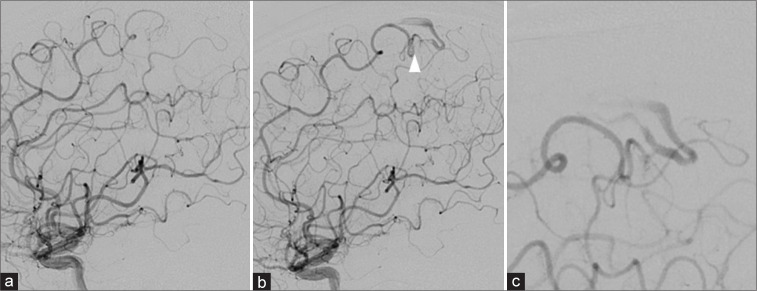 Figure 2: