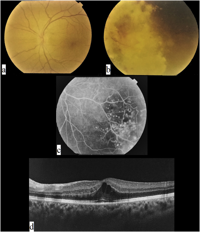 Fig. 1