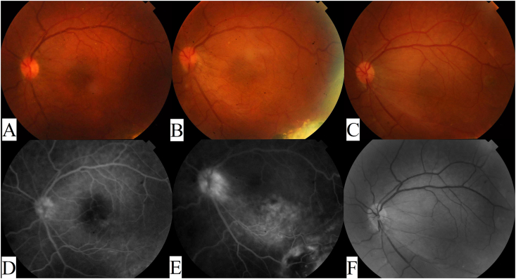 Fig. 2