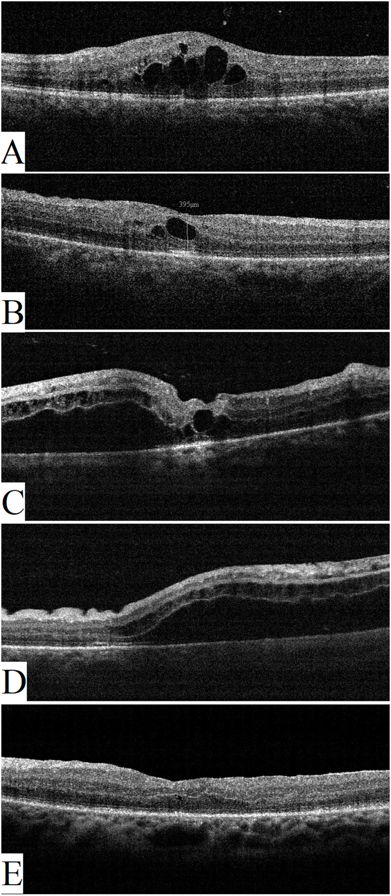 Fig. 4