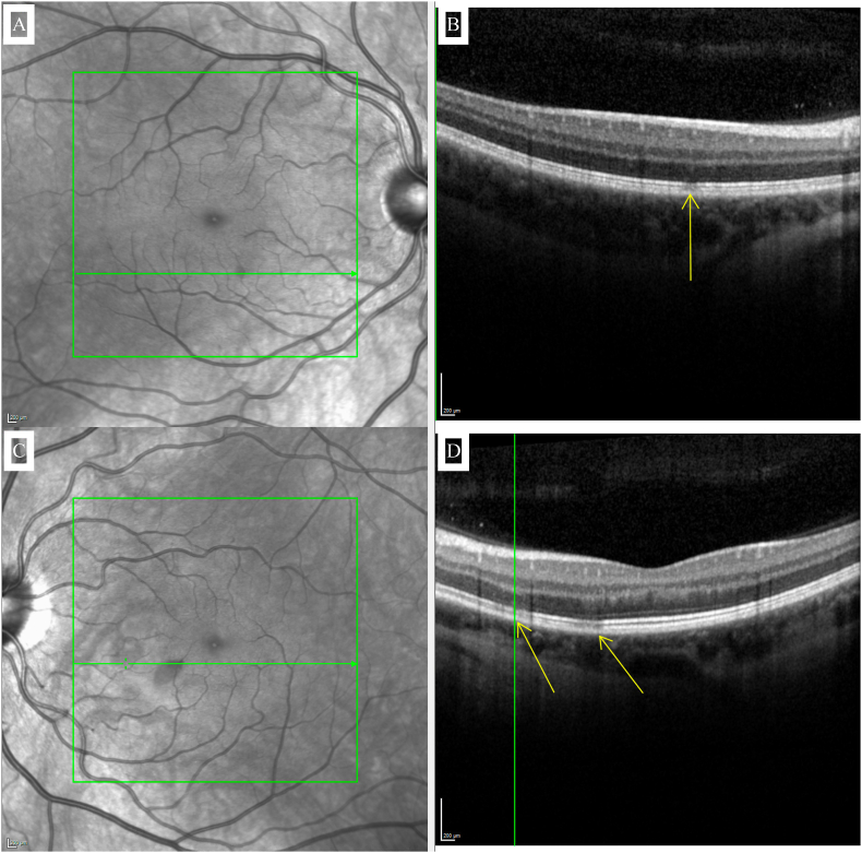 Fig. 4