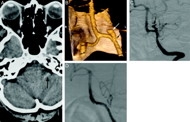 Fig 2.