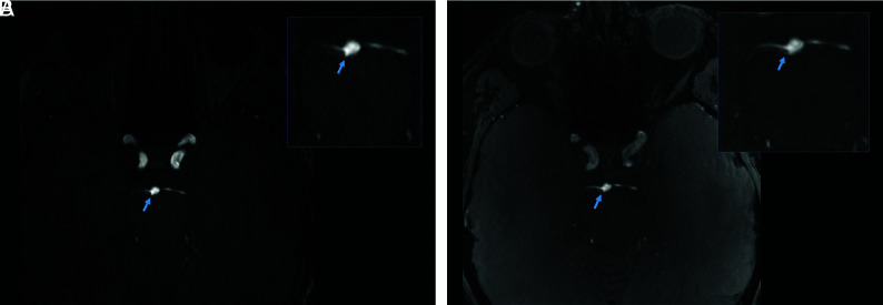 FIG 2.