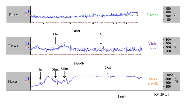 Figure 12