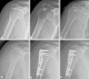 Fig. 4A–F