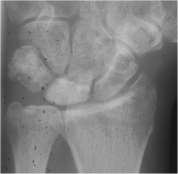 Fig. 5