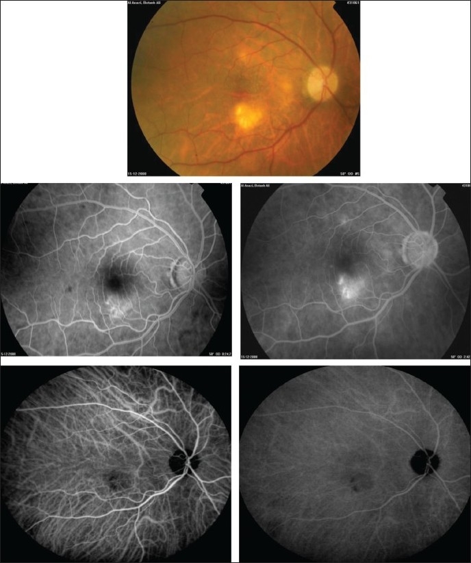 Figure 10