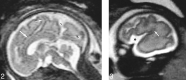 <sc>fig</sc> 2.