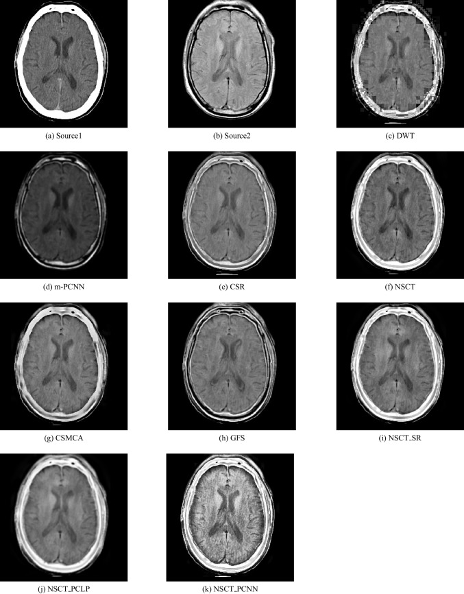 Fig. 7