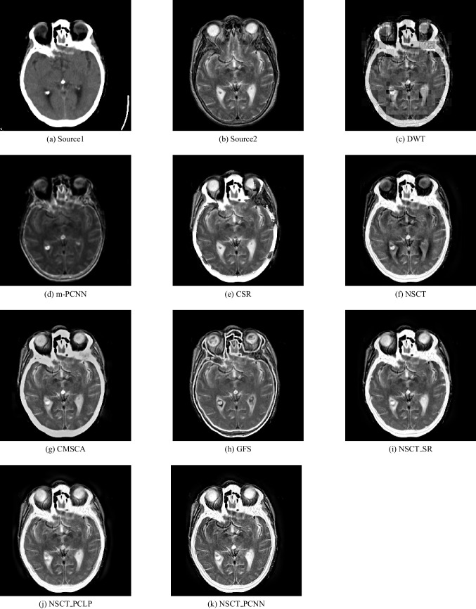 Fig. 8