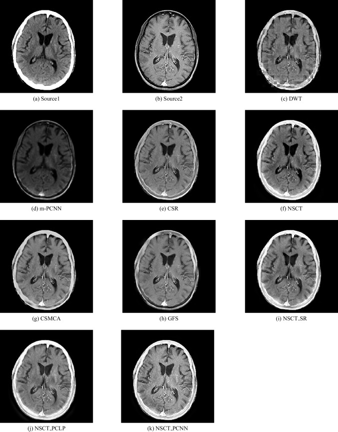 Fig. 6