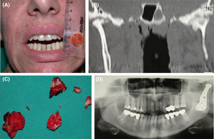 FIGURE 3