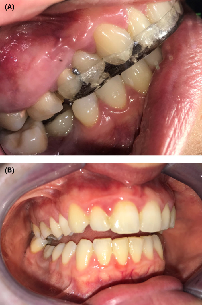 FIGURE 2