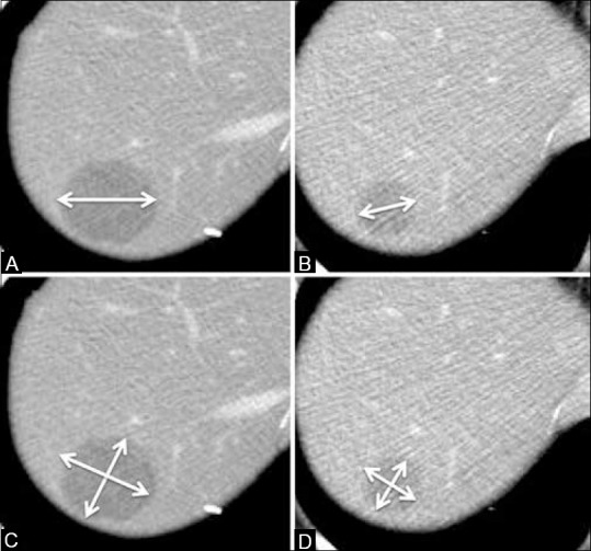 Figure 1 (A-D)