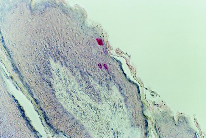 FIG. 3
