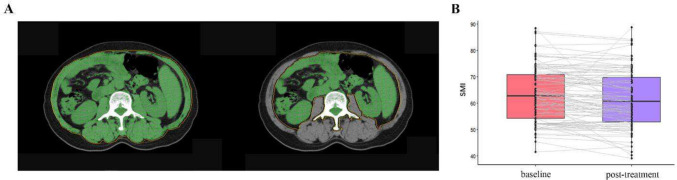 Fig. 1