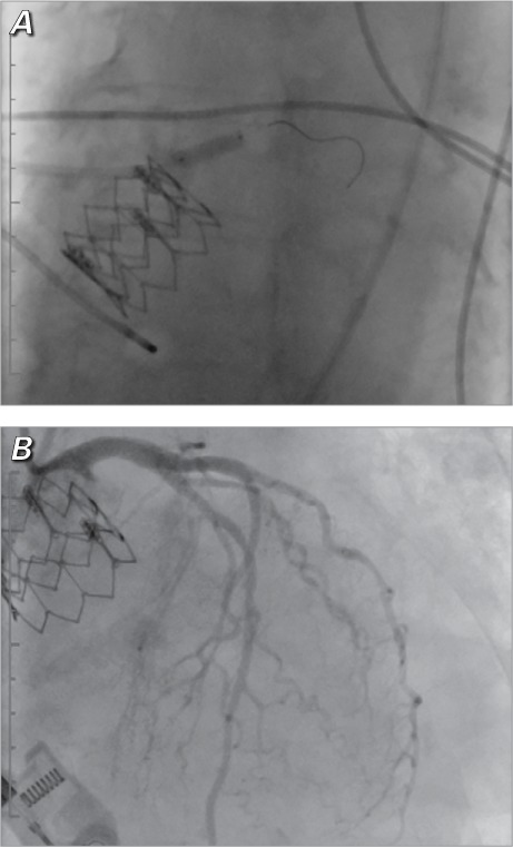 Fig. 5.