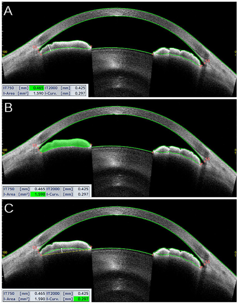 Figure 4