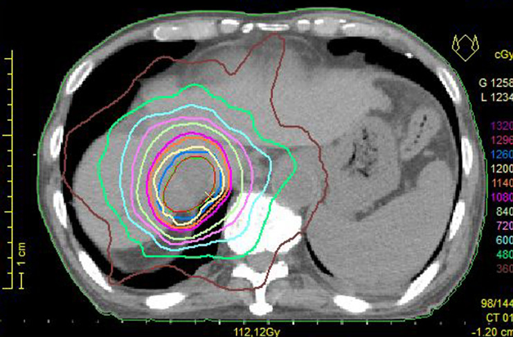 Fig. 3